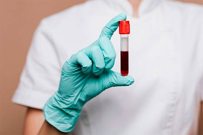 В Курганской области продолжается снижение числа заболевших ВИЧ-инфекцией